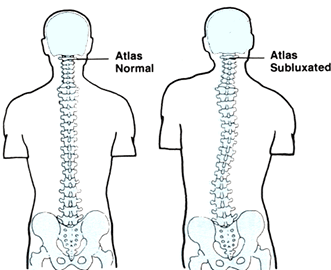 Atlas orthogonal chirpractic