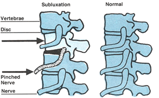 chiropractic adjustments